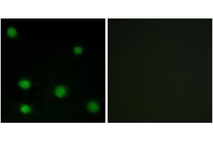 Immunofluorescence analysis of COS7 cells, using RBM6 Antibody. (RBM6 anticorps  (AA 991-1040))