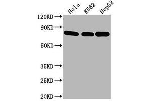 Western Blot Positive WB detected in: Hela whole cell lysate, K562 whole cell lysate, HepG2 whole cell lysate All lanes HSPA8 antibody at 1:2000 Secondary Goat polyclonal to mouse IgG at 1/50000 dilution Predicted band size: 70~75 KDa Observed band size: 70~75 KDa Exposure time: 5 min