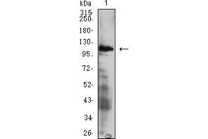 Western blot analysis using CD49D mAb against HEK293 (1) and CD49D (AA: extra 833-977))-hIgGFc transfected HEK293 (2) cell lysate.