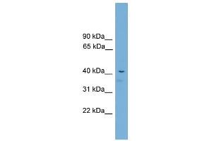 Acd antibody used at 2. (ACD anticorps  (C-Term))