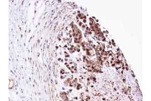 IHC-P Image Immunohistochemical analysis of paraffin-embedded SNU-16 xenograft, using TPI1 , antibody at 1:100 dilution. (TPI1 anticorps  (C-Term))