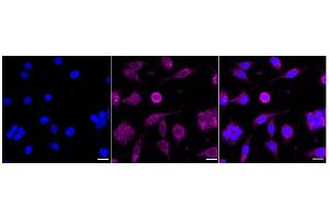 Immunocytochemical staining of HeLa cells with Retinoic acid receptor beta antibody (ABIN7800190), 1:1,000). (Recombinant Retinoic Acid Receptor beta anticorps)