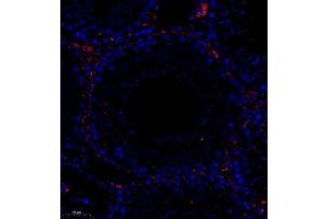 Immunofluorescence of paraffin embedded rat testis using colEC12 (ABIN7073552) at dilution of 1:650 (250x lens)