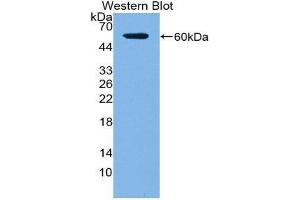 Western Blotting (WB) image for anti-Acid Phosphatase 5, Tartrate Resistant (ACP5) (AA 79-318) antibody (ABIN1857873) (ACP5 anticorps  (AA 79-318))