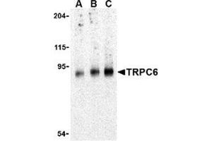 Western blot analysis of TRPC6 in mouse lung tissue lysate with this product at (A) 0. (TRPC6 anticorps  (C-Term))