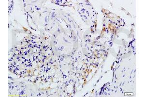 Formalin-fixed and paraffin embedded rat colitis tissue labeled with Anti-IL-1R1 CD121a IL1 Receptor I Polyclonal Antibody, unconjugated (ABIN747743) at 1:200 followed by incubation with conjugated secondary antibody and DAB staining (IL1R1 anticorps  (AA 481-569))