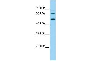 Host:  Rabbit  Target Name:  Slc9a8  Sample Type:  Rat Small Intestine lysates  Antibody Dilution:  1. (NHE8 anticorps  (N-Term))