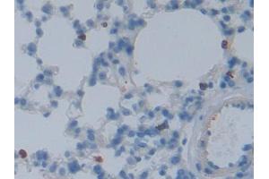 DAB staining on IHC-P; Samples: Mouse Lung Tissue