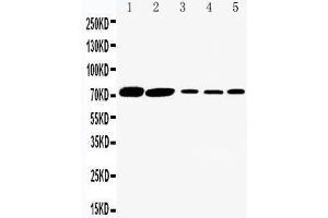 Anti-SGLT1 antibody, Western blotting Lane 1: Rat Kidney Tissue Lysate Lane 2: Rat Heart Tissue Lysate Lane 3: HELA Cell Lysate Lane 4: SW620 Cell Lysate Lane 5: COLO320 Cell Lysate (SLC5A1 anticorps  (C-Term))