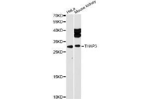 Western blot analysis of extracts of various cell lines, using THAP3 antibody (ABIN6293620) at 1:1000 dilution. (THAP3 anticorps)