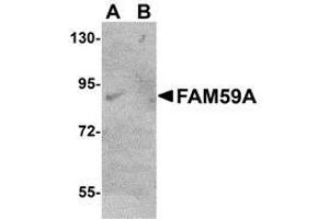 Western blot analysis of FAM59A in rat liver tissue lysate with AP30330PU-N FAM59A antibody at (A) 1 and (B) 2 μg/ml.