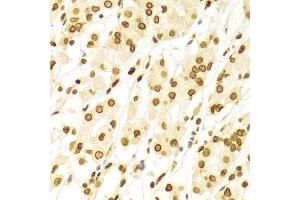 Immunohistochemistry of paraffin-embedded Human gastric using LMNA antibody at dilution of 1:100 (x400 lens).