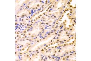 Immunohistochemistry of paraffin-embedded rat kidney using HDGF Antibody (ABIN1876535) at dilution of 1:100 (40x lens). (HDGF anticorps)