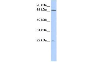 Western Blotting (WB) image for anti-DIRAS Family, GTP-Binding RAS-Like 1 (DIRAS1) antibody (ABIN2459582) (DIRAS1 anticorps)