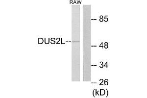 Western Blotting (WB) image for anti-Dihydrouridine Synthase 2-Like (DUS2L) (C-Term) antibody (ABIN1850012) (DUSL2 anticorps  (C-Term))
