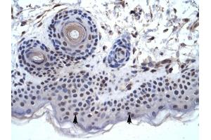 anti-Zinc Finger Protein 660 (ZNF660) (C-Term) antibody