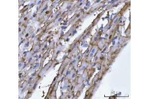anti-Tripartite Motif Containing 72 (TRIM72) (AA 28-477) antibody