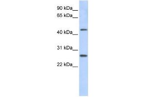 PRAMEF10 antibody used at 1 ug/ml to detect target protein. (PRAMEF10 anticorps  (Middle Region))