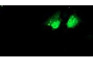 Anti-NHEJ1 mouse monoclonal antibody (ABIN2453926) immunofluorescent staining of COS7 cells transiently transfected by pCMV6-ENTRY NHEJ1 (RC203393). (NHEJ1 anticorps)