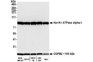 Western Blotting (WB) image for anti-alpha 1 Sodium Potassium Atpase antibody (ABIN7455086) (alpha 1 Sodium Potassium Atpase anticorps)