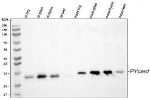Western blot analysis of TMS1/ASC/PYCARD using anti-TMS1/ASC/PYCARD antibody (ABIN7601174).