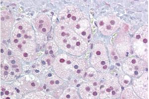 Immunohistochemistry with Adrenal tissue at an antibody concentration of 5µg/ml using anti-NR4A1 antibody (ARP45604_P050) (NR4A1 anticorps  (Middle Region))