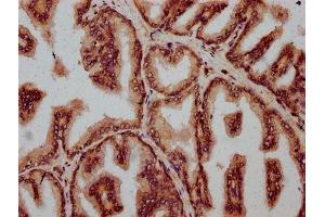 IHC image of ABIN7152402 diluted at 1:500 and staining in paraffin-embedded human prostate tissue performed on a Leica BondTM system.