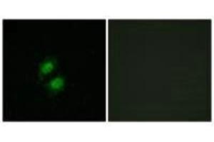 Immunofluorescence analysis of A549 cells, using ZNF95 antibody. (ZKSCAN5 anticorps)