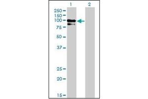 Western Blotting (WB) image for anti-Oculocerebrorenal Syndrome of Lowe (OCRL) (AA 146-240) antibody (ABIN782420)