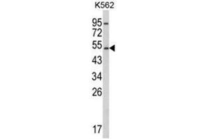 Western blot analysis of CYP2E1 Antibody (C-term) in K562 cell line lysates (35ug/lane). (CYP2E1 anticorps  (C-Term))