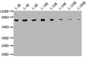 Western Blot Positive WB detected in: 20 μg Hela whole cell lysate HSPA8 antibody at 1:2000, 1:4000, 1:8000, 1:16000, 1:32000, 1:64000, 1:128000, 1:256000 Secondary Goat polyclonal to mouse IgG at 1/50000 dilution Predicted band size: 70~75 KDa Observed band size: 70~75 KDa Exposure time: 10s