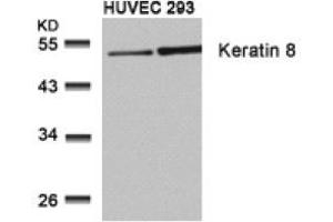 Image no. 3 for anti-Keratin 8 (KRT8) (Ser73) antibody (ABIN197582) (KRT8 anticorps  (Ser73))