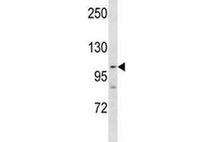 PARP 1 antibody western blot analysis in NCI-H460 lysate.