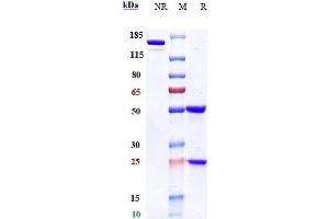 Anti-CD38 Reference Antibody (daratumumab) on SDS-PAGE under reducing (R) condition. (Recombinant CD38 (Daratumumab Biosimilar) anticorps)