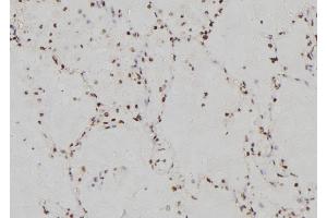 ABIN6262651 and ABIN6269358 at 1/100 staining Human lung tissue by IHC-P.