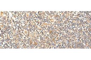 Immunohistochemistry of paraffin-embedded Human tonsil tissue using GPD1L Polyclonal Antibody at dilution of 1:60(x200) (GPD1L anticorps)