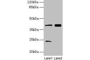 Western blot All lanes: MAP2K3 antibody at 10 μg/mL Lane 1: RAW264. (MAP2K3 anticorps  (AA 1-347))