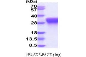 SDS-PAGE (SDS) image for CD300c (CD300C) (AA 29-183) protein (His tag) (ABIN6387981)