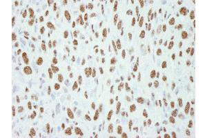 Immunohistochemistry (IHC) image for anti-Transcription Elongation Regulator 1 (TCERG1) (AA 1-50) antibody (ABIN7448453) (TCERG1 anticorps  (AA 1-50))