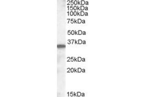 Western Blotting (WB) image for anti-Solute Carrier Family 10 (Sodium/bile Acid Cotransporter Family), Member 2 (SLC10A2) (AA 337-348) antibody (ABIN343101) (SLC10A2 anticorps  (AA 337-348))