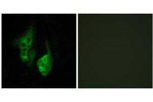 Immunofluorescence analysis of HeLa cells, using OPN5 antibody. (OPN5 anticorps  (C-Term))