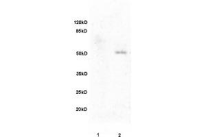 L1 rat brain, L2 human colon carcinoma lysates probed (ABIN728473) at 1:200 in 4 °C.