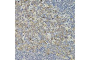 Immunohistochemistry of paraffin-embedded mouse spleen using IRF1 antibody. (IRF1 anticorps)