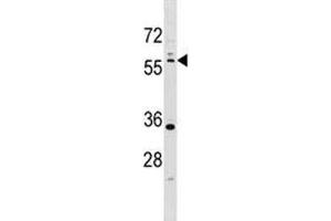 LKB1 antibody western blot analysis in T47D lysate.