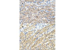 Immunohistochemical staining (Formalin-fixed paraffin-embedded sections) of (A) and (B) human heart with MBNL1 polyclonal antibody . (MBNL1 anticorps  (AA 211-260))