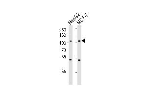 Western blot analysis of lysates from HepG2, MCF-7 cell line (from left to right), using P4K3 Antibody (ABIN659123 and ABIN2843762).