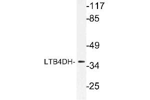 Western blot (WB) analysis of LTB4DH antibody in extracts from HT-29 cells.