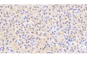 Detection of ACY1 in Human Liver Tissue using Polyclonal Antibody to Aminoacylase 1 (ACY1) (Aminoacylase 1 anticorps  (AA 2-408))