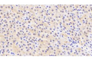 Detection of ACY1 in Human Liver Tissue using Polyclonal Antibody to Aminoacylase 1 (ACY1) (Aminoacylase 1 anticorps  (AA 2-408))