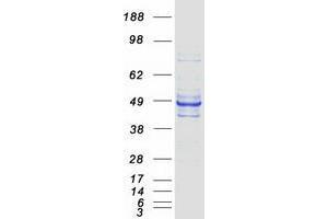 Validation with Western Blot